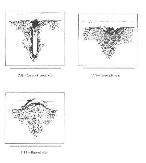 wpe01967.gif (228118 bytes)